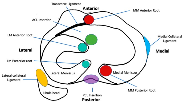 圖1：脛骨平臺水平的軸向截面示意圖，描繪了半月板的解剖結構、附件和關系