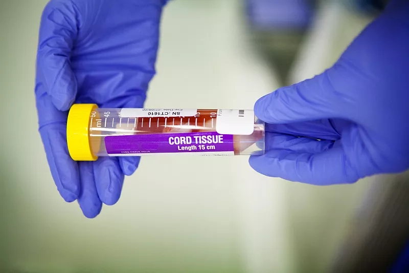 間充質(zhì)干細(xì)胞的優(yōu)點(diǎn)有哪些? 間充質(zhì)干細(xì)胞的優(yōu)點(diǎn)有哪些?