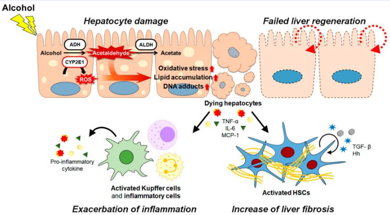 酒精及其代謝物通過各種途徑和/或機制共同促進ALD的發病機制。（如圖1）