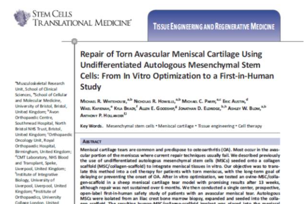 間充質干細胞能夠幫助修復受損的半月板組織，不用手術切除受傷部位也能讓膝關節功能恢復正常。