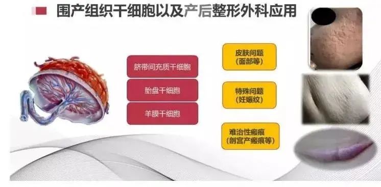 圍產組織細胞以及產后整形外科應用