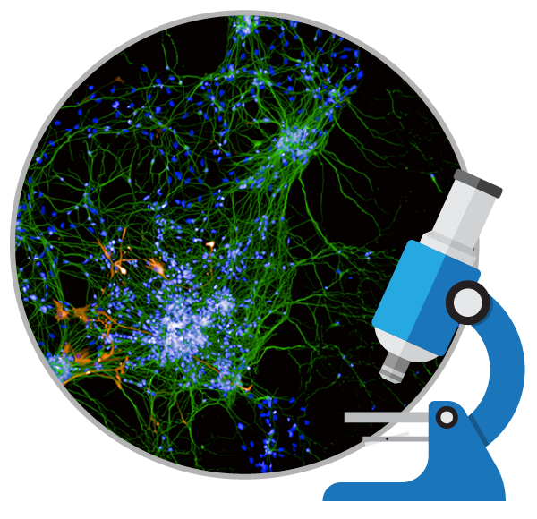 干細胞能治療好阿爾茨海默癥嗎？