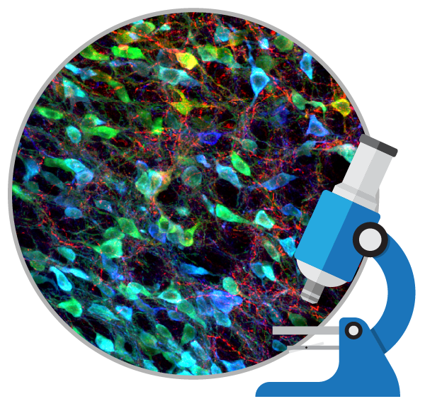 盤點：干細(xì)胞移植治療帕金森病的臨床研究進展