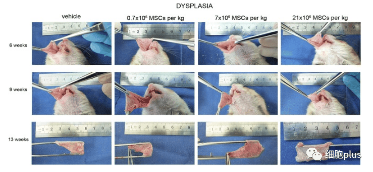 在腫瘤增生期，全身注射同種異體間充質干細胞不會加速癌前病變的進展。