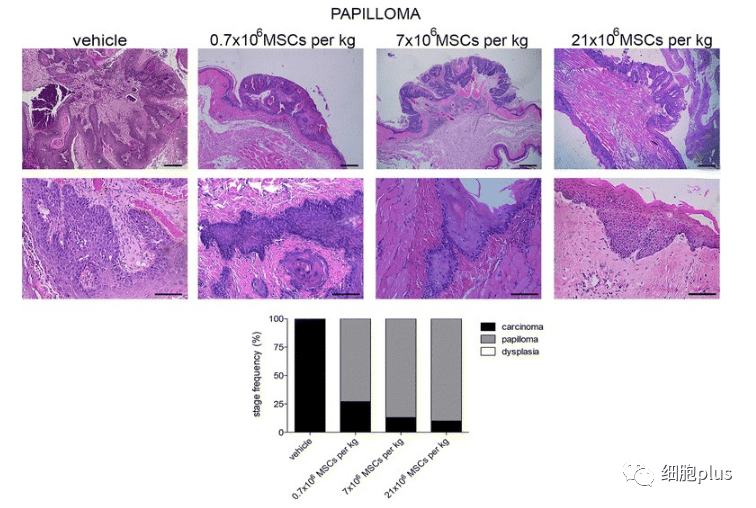 在非典型增生期，全身注射同種異體間充質干細胞不會增加腫瘤的惡性程度。