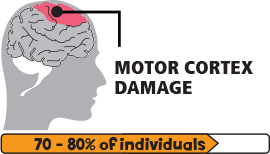 痙攣性腦癱圖標