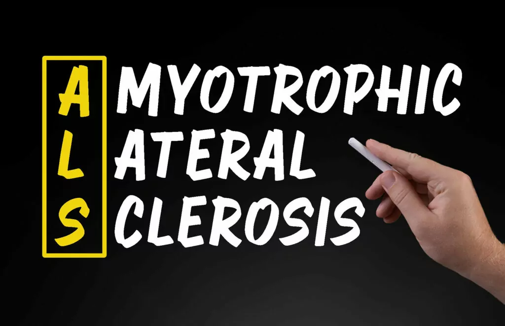 干細(xì)胞治療背景下的肌萎縮側(cè)索硬化癥