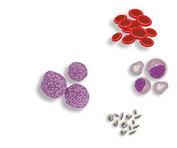 用于移植的干細(xì)胞可以來(lái)自骨髓或血液