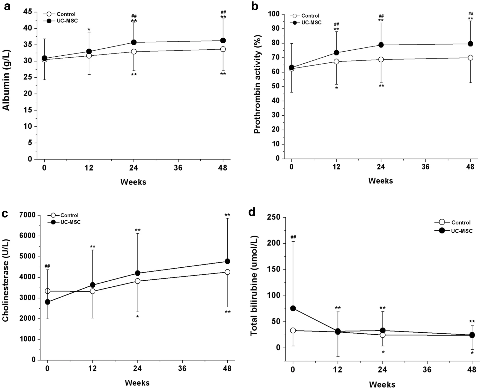 臍帶間充質干細胞治療對失代償期肝硬化患者肝功能的影響