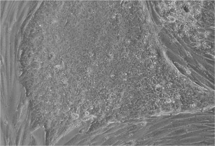 胚胎干細(xì)胞移植的來(lái)源