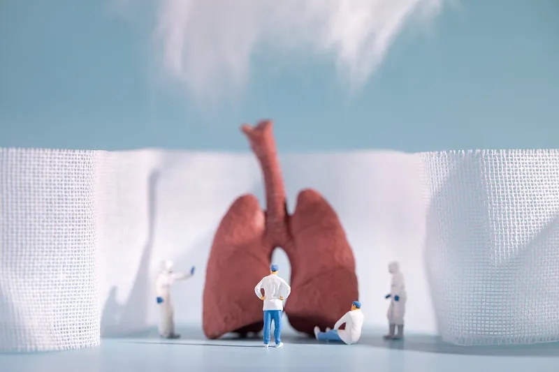 慢性阻塞性肺病(COPD)的四個(gè)階段 慢性阻塞性肺病(COPD)的四個(gè)階段