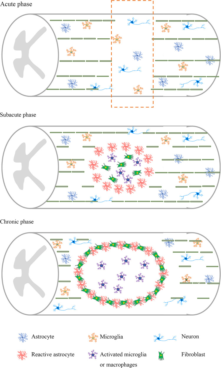 圖1：脊髓損傷不同階段的病理特點(diǎn)。