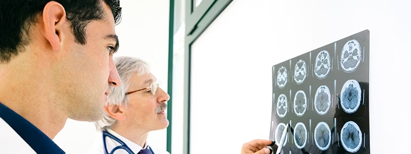 中風期間會發生什么?癥狀、后果和治療方案是什么? 中風期間會發生什么?癥狀、后果和治療方案是什么?