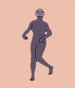 運動障礙型腦癱涉及過度的不自主運動。
運動障礙性腦癱的類型
肌張力障礙：僵硬和松弛交替出現(xiàn)，
舞蹈徐徐樣腦癱：持續(xù)的不自主運動導(dǎo)致姿勢異常。