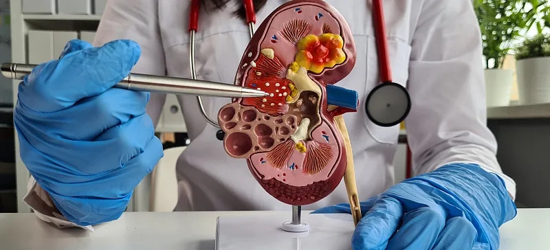 狼瘡的治療方法有哪些？