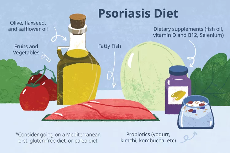 適合銀屑病患者吃的5種食物，你知道幾種？