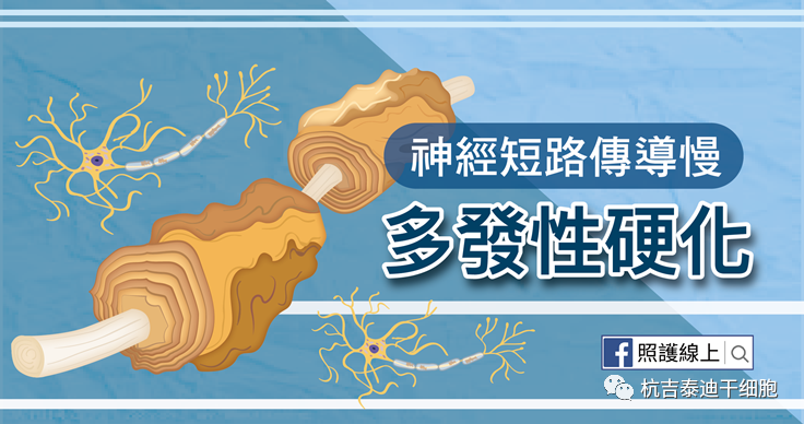 干細胞作為神經退行性疾病的潛在治療方法之多發性硬化癥篇