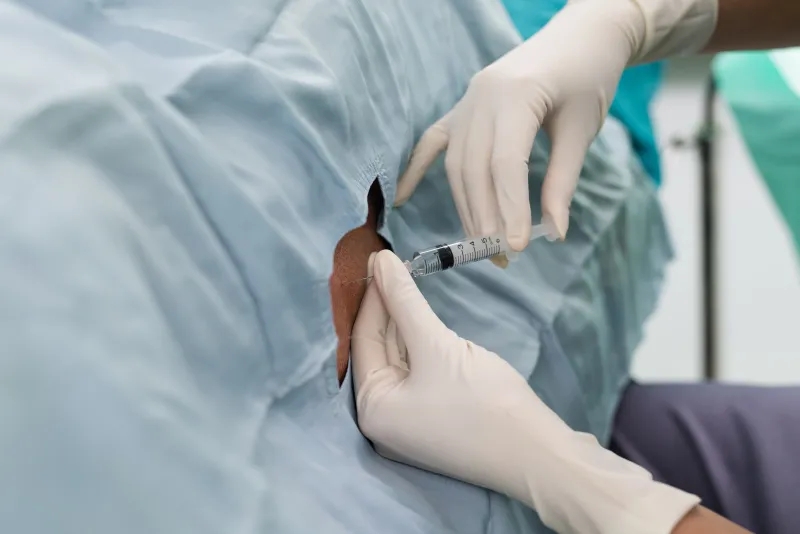 干細胞，-鞘內(nèi)給藥，-神經(jīng)系統(tǒng)疾病