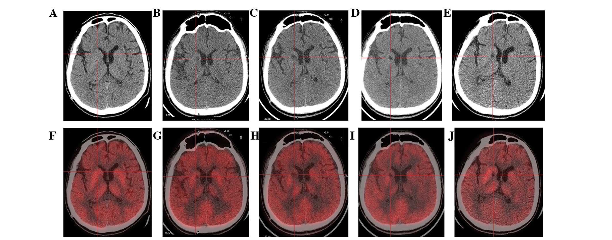 圖1：計算機斷層掃描 (CT) 和正電子發射斷層掃描 (PET) 掃描。