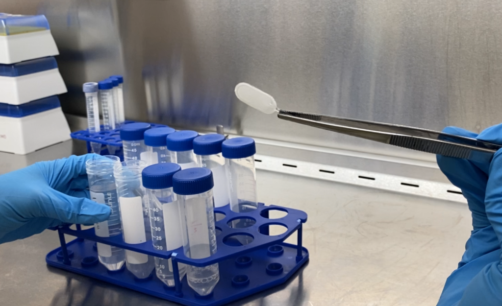 基于干細(xì)胞的療法為1型糖尿病患者制造胰島素