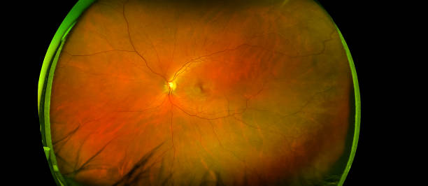 北大人民醫(yī)院眼科研究所：干細(xì)胞治療遺傳性視網(wǎng)膜疾病研究看點