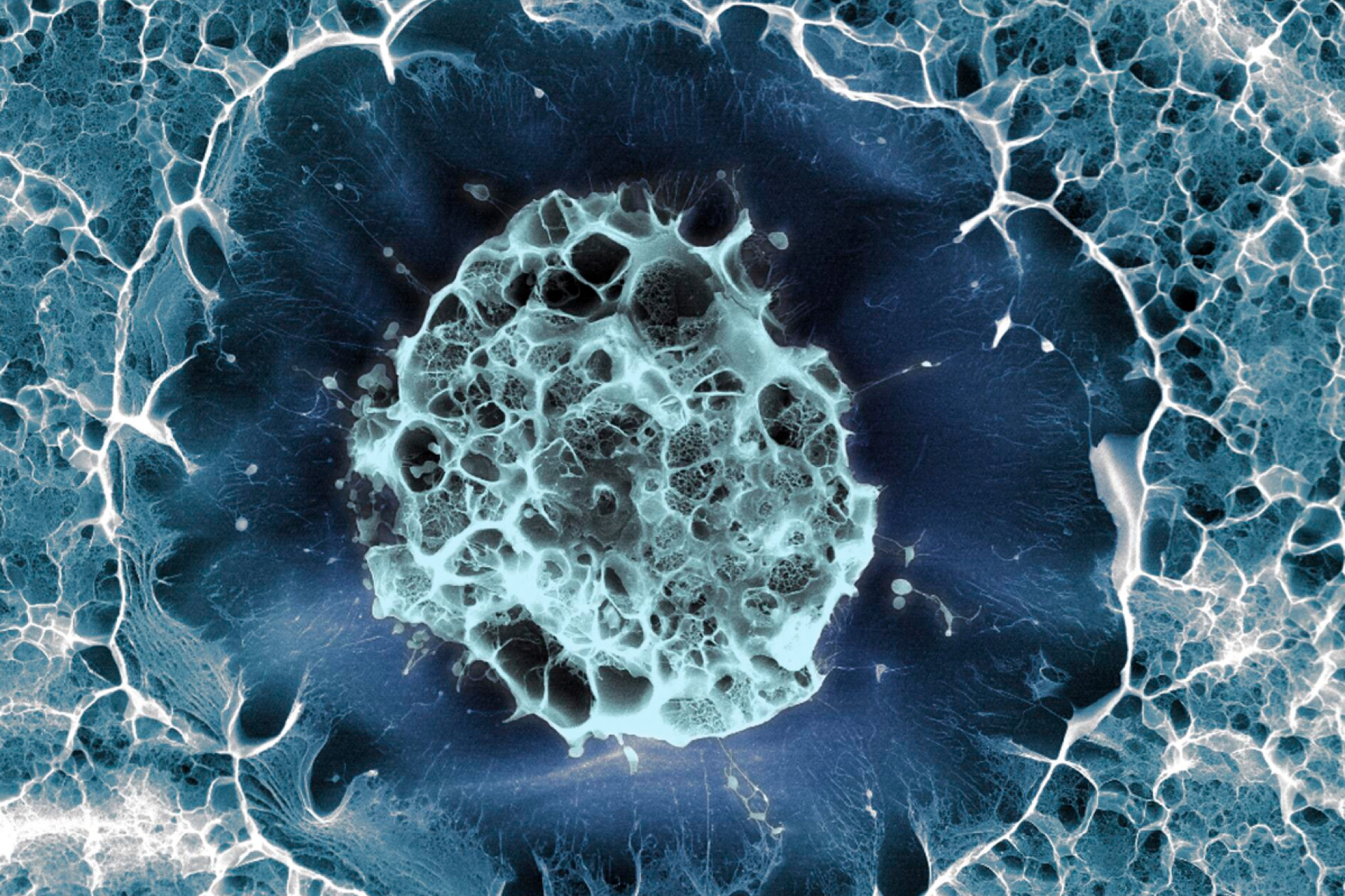 基于人類干細胞的帕金森病療法被證明是安全的