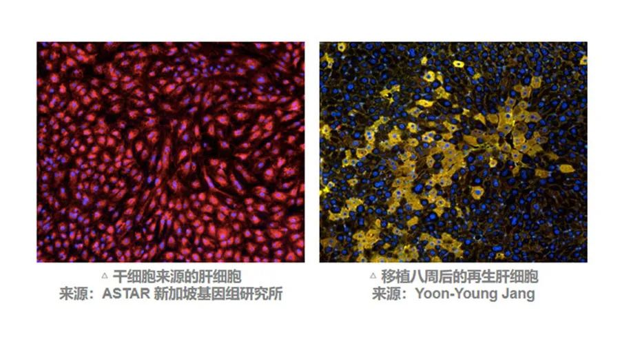MSC有望通過不同途徑調(diào)動(dòng)肝臟細(xì)胞再生來改善預(yù)后。