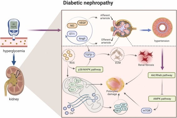 圖1：糖尿病腎病的病理信號(hào)。
