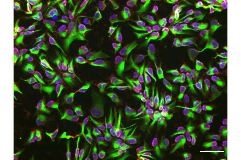 神經(jīng)干細胞 神經(jīng)干細胞