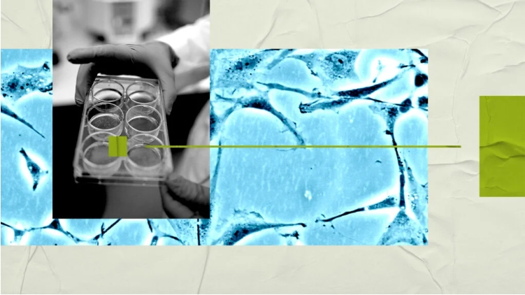 研究人員稱，大腦研究可能有助于開發新的精神分裂癥治療方法。
