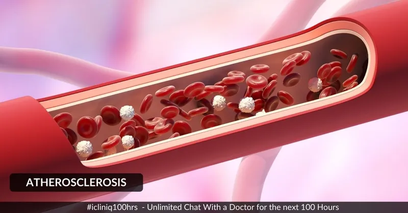 動(dòng)脈粥樣硬化的體征和癥狀是什么？治療方案有哪些？