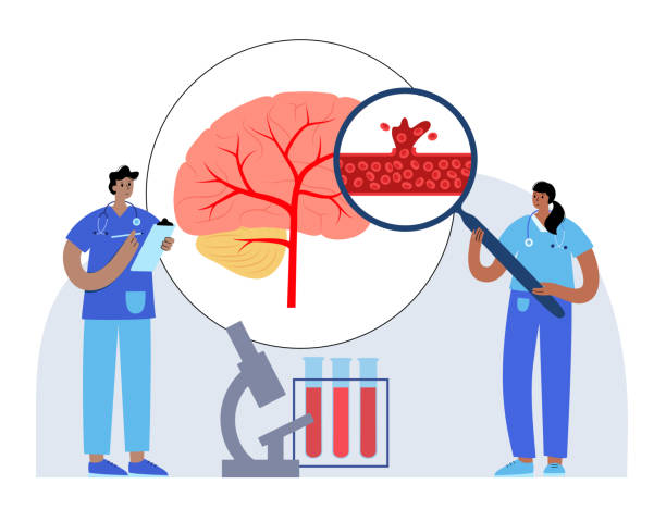 圍產(chǎn)期中風(fēng)-類型、原因和風(fēng)險(xiǎn)因素