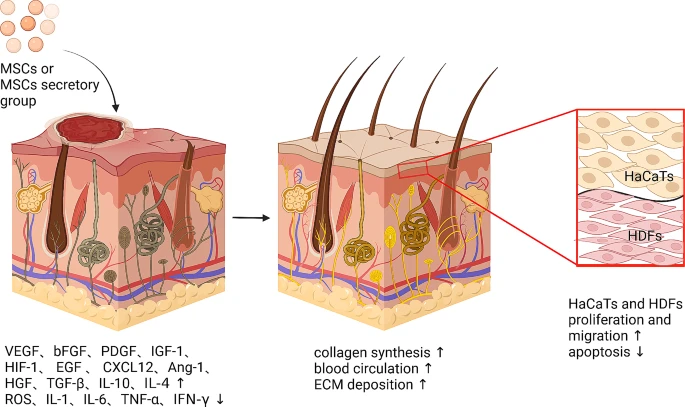 圖5:間充質(zhì)干細(xì)胞促進皮膚創(chuàng)面愈合的機制。 圖5:間充質(zhì)干細(xì)胞促進皮膚創(chuàng)面愈合的機制。