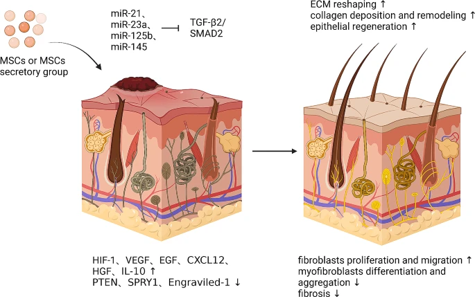 圖6:間充質(zhì)干細(xì)胞促進皮膚疤痕修復(fù)的機制。 圖6:間充質(zhì)干細(xì)胞促進皮膚疤痕修復(fù)的機制。