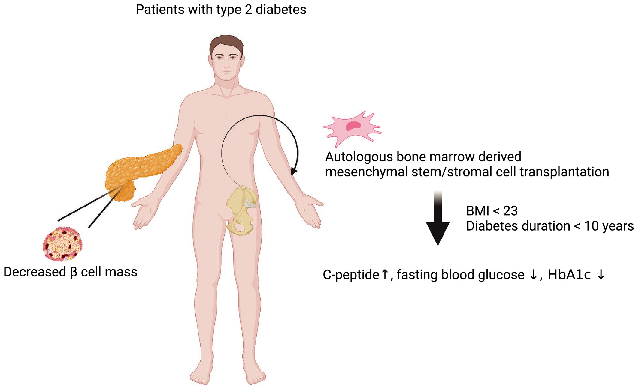 圖1:自體骨髓間充質/基質干細胞移植可以安全地改善2型糖尿病患者的高血糖癥并恢復C肽水平。 圖1:自體骨髓間充質/基質干細胞移植可以安全地改善2型糖尿病患者的高血糖癥并恢復C肽水平。