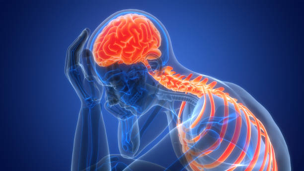 什么是缺血性腦中風，癥狀、原因、診斷和治療