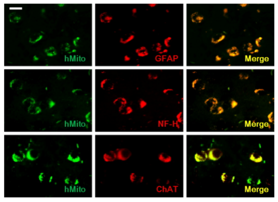 干細(xì)胞移植到小鼠腦組織后分化成神經(jīng)元和星細(xì)胞