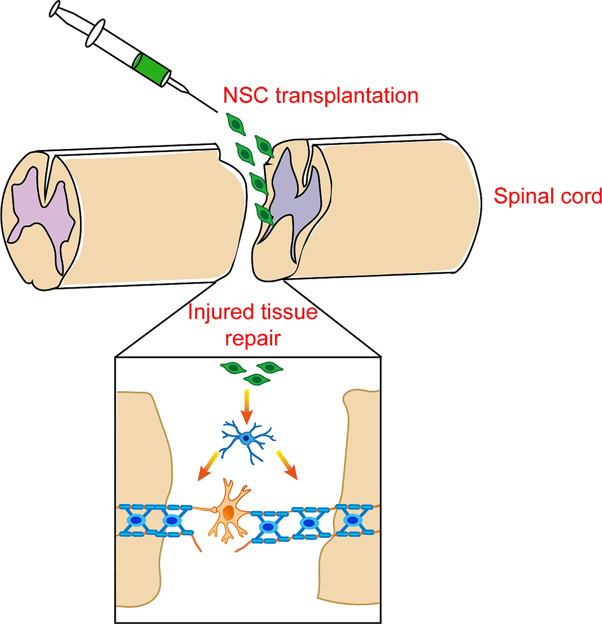 圖3：神經干細胞移植在脊髓損傷修復和恢復中的應用