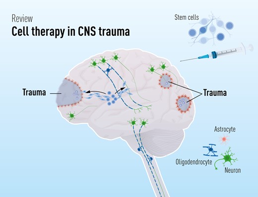 干細胞療法修復中樞神經系統創傷：4個原則—什么、何時、何地和為什么