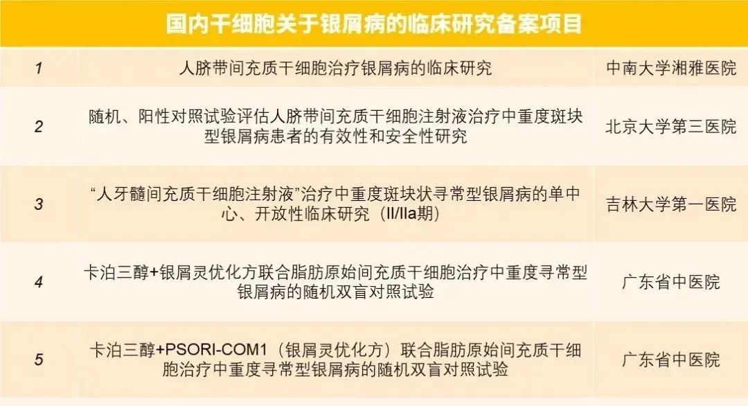 國內(nèi)干細胞關(guān)于銀屑病的臨床研究備案項目
