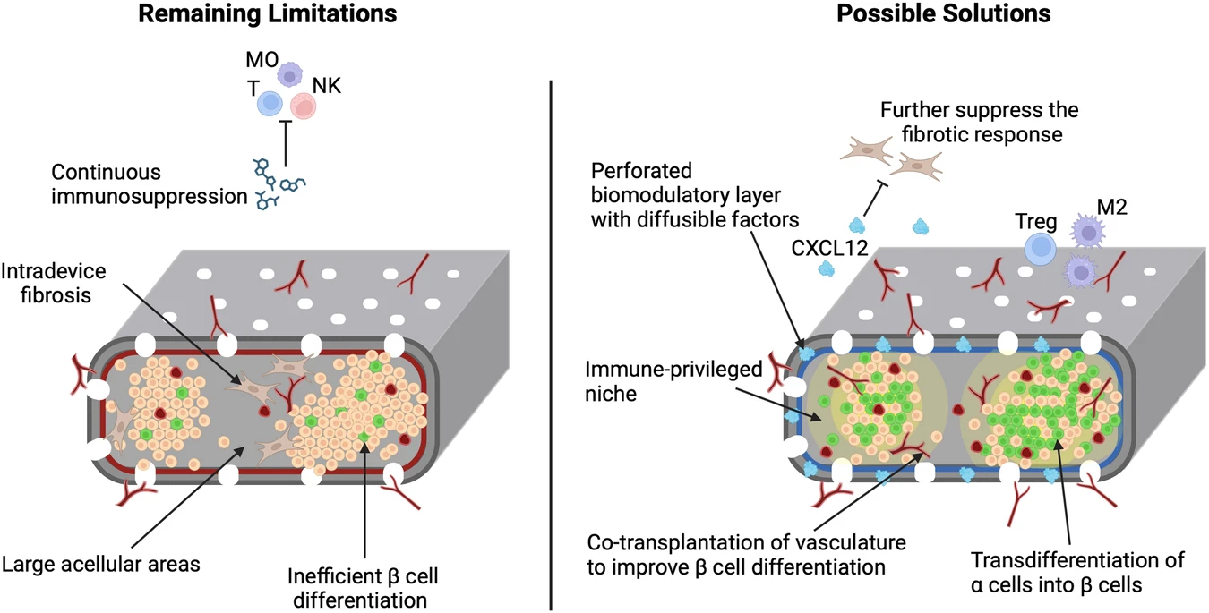 圖2：增加功能性β細(xì)胞質(zhì)量和消除全身免疫抑制的策略