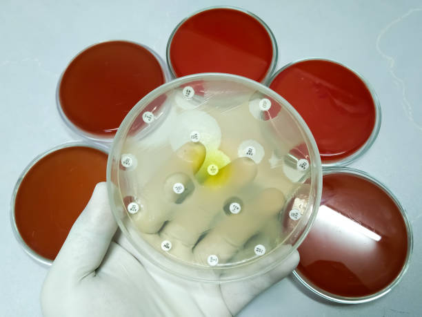 骨髓移植成功率100％嗎？