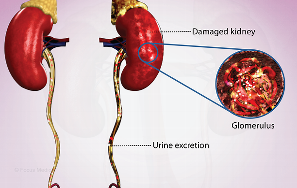 近10年國內進行干細胞治療急性腎損傷臨床研究的醫院有哪些？