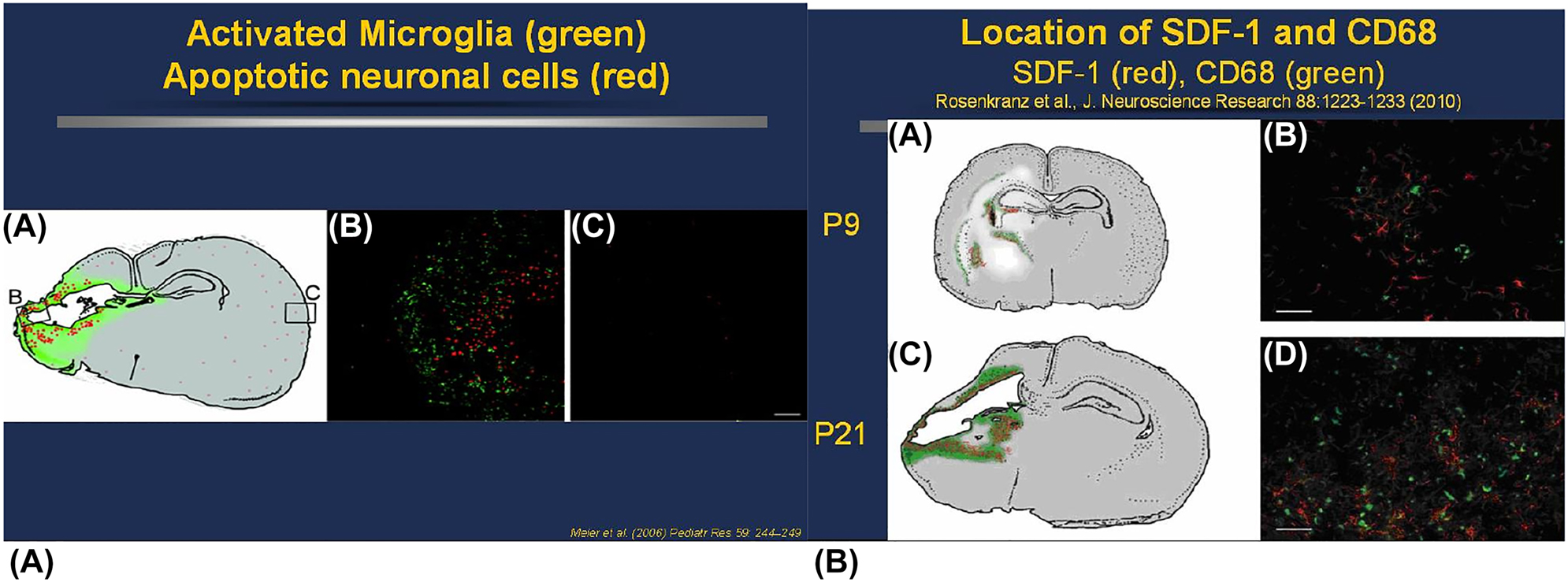 新生大鼠PN9和 PN21 HI后激活的小膠質細胞和SDF-1表達