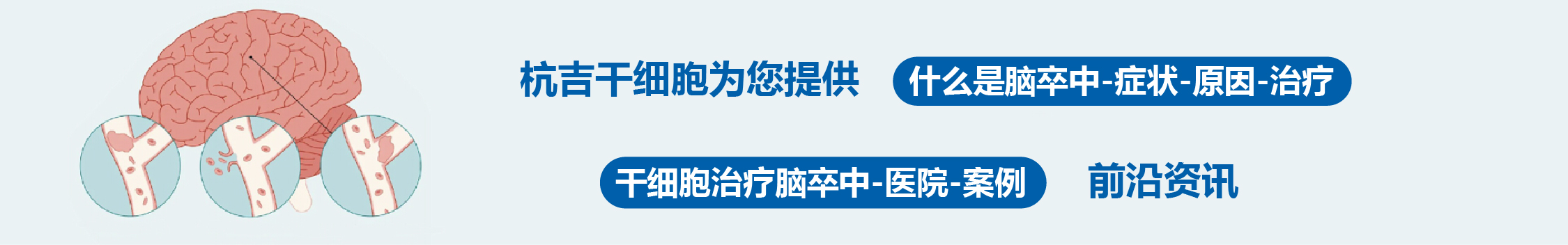 國內外干細胞醫院治療腦卒中的臨床案例