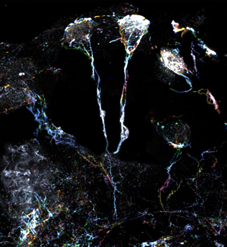 果蠅大腦中處于休眠狀態(tài)的神經(jīng)干細胞具有富含肌動蛋白絲的突起