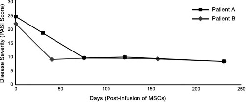 圖 1?. 移植 MSCs 前后兩例患者的銀屑病面積和嚴重程度指數 (PASI) 評分總結。在輸注 MSCs 后的隨訪中，每例患者的 PASI 評分均有所下降。評分由第三方皮膚科醫生進行。臨床改善持久，患者 A 的改善持續超過 150 天，患者 B 的改善持續超過 200 天。