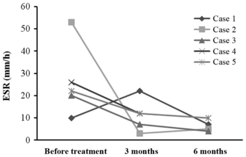 每位患者治療前后的 CRP 水平。1 名患者的 CRP 水平降低，而其他 4 名患者的 CRP 水平保持穩定并在正常范圍內。CRP，C 反應蛋白。