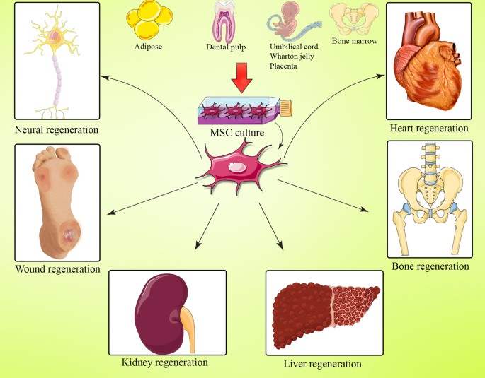 間充質(zhì)干細(xì)胞(MSC) 是一種多能細(xì)胞，可分化為基質(zhì)譜系細(xì)胞。間充質(zhì)干細(xì)胞(MSC) 是骨髓 (BM-MSC)、脂肪組織、肝臟、羊水、胚胎胎盤(pán)、臍帶血和其他組織中的一組非造血細(xì)胞。骨髓間充質(zhì)干細(xì)胞能夠抑制與GVHD病理生理學(xué)有關(guān)的大多數(shù)免疫細(xì)胞的激活和功能。
