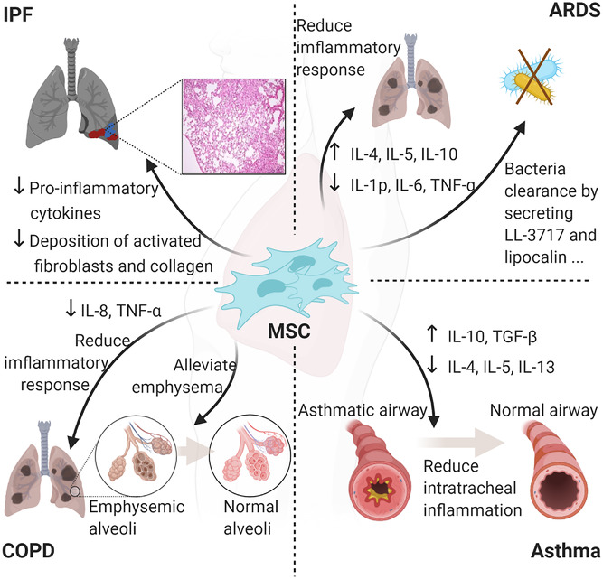 間充質干細胞在特發性肺纖維化 (IPF)、急性呼吸窘迫綜合征 (ARDS)、慢性阻塞性肺疾病 (COPD) 和哮喘中的主要作用 間充質干細胞在特發性肺纖維化 (IPF)、急性呼吸窘迫綜合征 (ARDS)、慢性阻塞性肺疾病 (COPD) 和哮喘中的主要作用